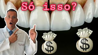 QUANTO CUSTA LENTES DE CONTATO DENTAL  AntesDepois VOU FALAR O PREÇO Vídeo COMPLETO pra DECIDIR [upl. by Esyle371]