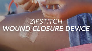 ZipStitch Wound Closure Device [upl. by Gunning83]