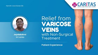 Relief from Varicose Veins with NonSurgical Treatment patienttestimonial srilanka [upl. by Evangelina549]