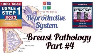 Breast pathologyCancer from Pathoma in urdu Part4 Reproductive system pathUrduHindi [upl. by Novia]