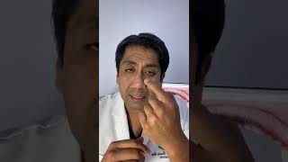 CONJUNTIVITIS TIPOS Y TRATAMIENTO DR VICTOR TORREALVA OFTALMÓLOGO [upl. by Assila513]