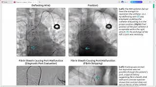 INTERVENTIONAL RADIOLOGY DIAGNOSTIC IMAGING SERIES [upl. by Sihon235]