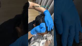 Achieve Full Hair in Just 5 Months [upl. by Naujat]