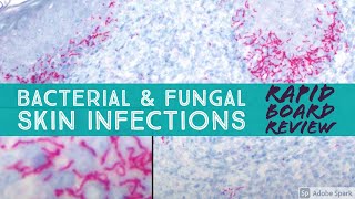 Infectious Dermpath bacterial amp fungal Board Review for Dermatology amp Pathology 20 cases [upl. by Yankee]