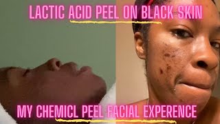 Lactic acid Chemical peel on black skin the facial appointment [upl. by Notna]