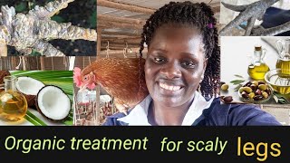 DONT BUY CHICKEN MEDICINE AGAIN How to treat scaly legs organically in poultry farming 🙏 [upl. by Asia]