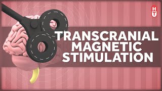 Transcranial Magnetic Stimulation How Does that Work [upl. by Eenot]