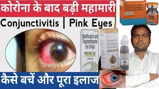 Conjunctivitis eye infectioneyefluquotआँख आ जानाquot Pink Eyes Cause Symptoms amp Treatment in hindipk [upl. by Debera]