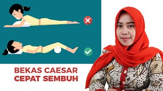 Posisi Tidur Setelah Melahirkan Caesar Agar Cepat Sembuh [upl. by Hennahane524]