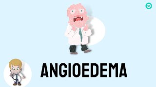 Angioedema signs amp symptoms causes and treatment [upl. by Arv]