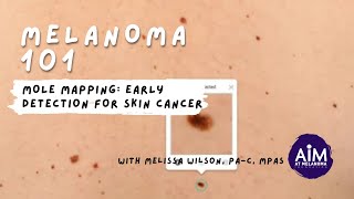 How to Use Mole Mapping to Detect Skin Cancer [upl. by Cardew]