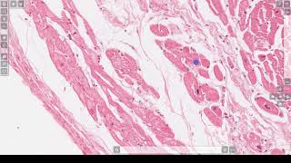 LG14 Normal Cardiac Histology 3 min [upl. by Ydderf]