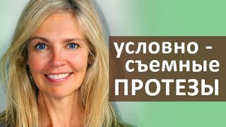 😃 Протез на имплантах Что такое условно съемный протез зубов на имплантах Стоматология Тандем [upl. by Ewan47]