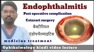 endophthalmitis  endophthalmitis treatment  endophthalmitis  endophthalmitis disease [upl. by Latham371]