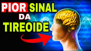 7 SINAIS PERIGOSOS do HIPERTIREOIDISMO Sintomas da Tireoide Produzindo Muitos Hormônios T3 e T4 [upl. by Badr]