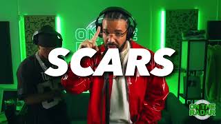 FREE Drake x Central Cee sampled drill type beat  SCARS  2024 Ny Drill type beat [upl. by Dawes]