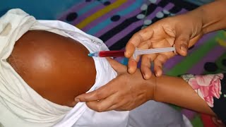 Arm Injection Push Vitamin B1B6B12 injection video Nugesic 24 Ep 32 By Injection Media [upl. by Ainotal]