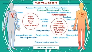 What is syncope and how to manage it [upl. by Ystap]