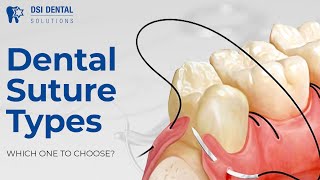 Dental Suture Types  which one to choose [upl. by Ahsekyt29]