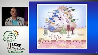 Recurrent FSGS What’s New  UCSF Kidney Transplant Program  Update in Transplantation 2013 [upl. by Verneuil718]