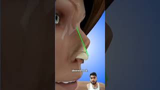 piercing beauty skincare satisfying nose nosejobs rhinoplastycost plasticsurgery rhinoplast [upl. by Attennod]