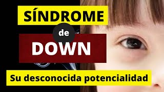 SÍNDROME DE DOWN Su desconocida potencialidad [upl. by Ynamad494]