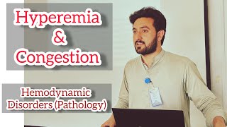 Hyperemia and Congestion  Hemodynamic disorders by Abdul Waheed Urdu Hindi lecture [upl. by Manno]