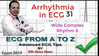 ECG from A to Z intermediate level Arrhythmia 31 Dr Alaa Nasr 201 [upl. by Aikan]