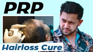 PRP Therapy  Before amp After Side Effects amp Benefits  PRP Cost In Bangladesh [upl. by Jeremie313]