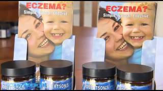 Eczema Ointment Today Tonight Adelaide [upl. by Alad]