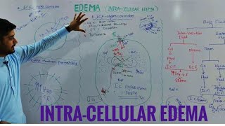 Intracellular edema pathophysiologyedema part 2 [upl. by Yrkcaz]