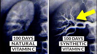 We Finally Know What Type Of Vitamin C Is Best [upl. by Poliard]