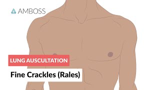 Fine Crackles Rales  Lung Auscultation  Episode 2 [upl. by Adamson]