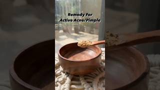 How to get rid of Acne  Acne treatment at home  pimples removal on face at home  short skincare [upl. by Venu328]