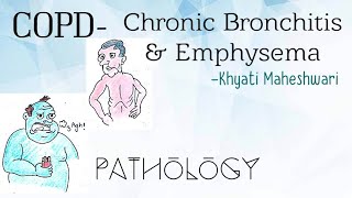 COPD Chronic Bronchitis and Emphysema Pathology [upl. by Polard27]