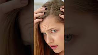 Minoxidil hisar hairtransplantdelhincr dermatologist motivation biohairtransplantclinic [upl. by Annaihs]