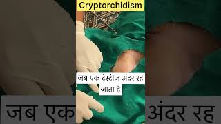 Cryptorchidism l Dr Umar Khan [upl. by Eirb]