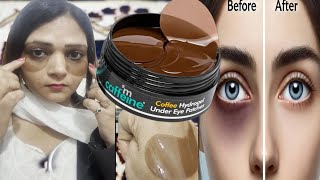 How can I remove dark circles permanentlyHow to get rid of dark circles under eyes permanently [upl. by Fiester433]