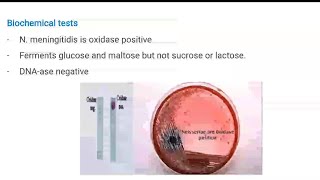 3Microbiology Lab  CNS  Neisseria meningitis للدكتور محمد حلبوب [upl. by Meldon]