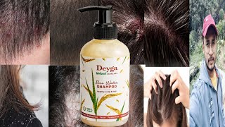 Deyga Rice Water Shampoo  Honest Review [upl. by Musa815]