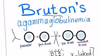 Brutons agammaglobulinemia Xlinked agammaglobulinemia with a mnemonic [upl. by Lleoj586]