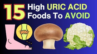 15 High Uric Acid Foods To Avoid For Gout  VisitJoy [upl. by Stephenie]