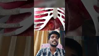 Liver abscess kise kahte hai janiye [upl. by Eicyac12]