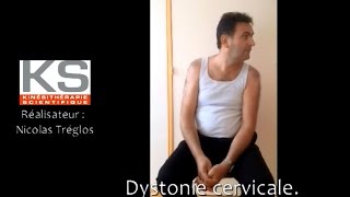 Dystonie cervicale torticolis rotatoire gauche [upl. by Danyelle411]