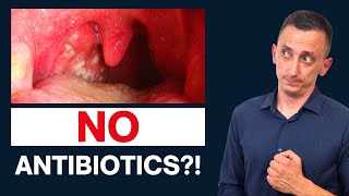 Antibiotics for Strep Throat Do We Need Them [upl. by Lamdin88]