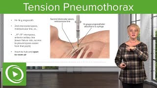 Tension Pneumothorax EMERGENCY Dont Miss This Crucial Diagnosis [upl. by Hakaber983]