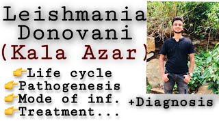 Leishmania donovani  life cycle  diagnosisTreatment etc Leishmania Leishmaniasis Parasitology [upl. by Ellswerth]