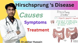 Hirschsprung Disease in hindi [upl. by Erhard]