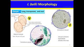 Isospora belli [upl. by Winslow]