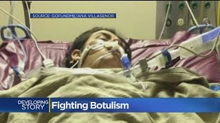 Teen Fighting Botulism In Hospital From Nacho Cheese [upl. by Notgnirrab90]